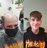 Sehen Sie hier die Möglichkeiten für Ihr neues Zweithaar Sehen Sie hier die Möglichkeiten für Ihr neues Zweithaar